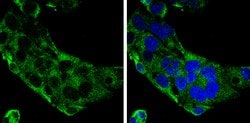 Invitrogen Complement C9 Polyclonal Antibody 100 &mu;L; Unconjugated:Antibodies,