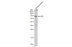 Invitrogen Complement C9 Polyclonal Antibody 100 &mu;L; Unconjugated:Antibodies,