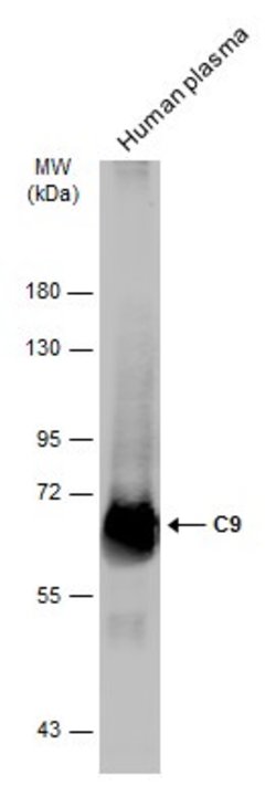 Invitrogen Complement C9 Polyclonal Antibody 100 &mu;L; Unconjugated:Antibodies,