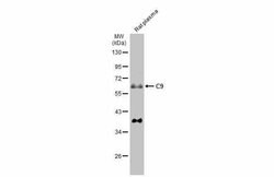 Invitrogen Complement C9 Polyclonal Antibody 100 &mu;L; Unconjugated:Antibodies,
