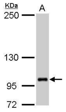 Invitrogen ZFPM2 Polyclonal Antibody 100 &mu;L; Unconjugated:Antibodies,