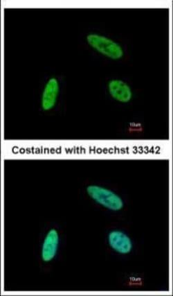 Invitrogen SNW1 Polyclonal Antibody 100 &mu;L | Buy Online | Invitrogen&trade; | Fisher Scientific