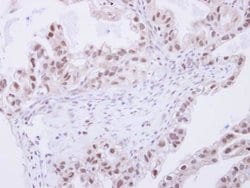 Invitrogen SNW1 Polyclonal Antibody 100 &mu;L | Buy Online | Invitrogen&trade; | Fisher Scientific