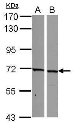Invitrogen SNW1 Polyclonal Antibody 100 &mu;L | Buy Online | Invitrogen&trade; | Fisher Scientific
