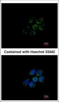 Invitrogen ALDH5A1 Polyclonal Antibody 100 &mu;L; Unconjugated:Antibodies,