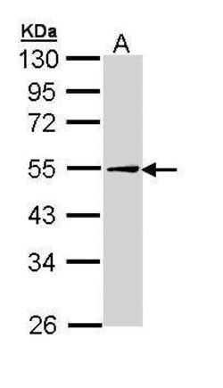 Invitrogen ADFP Polyclonal Antibody 100 &mu;L | Buy Online | Invitrogen&trade; | Fisher Scientific