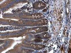 Invitrogen PLA2G4A Polyclonal Antibody 100 &mu;L; Unconjugated:Antibodies,