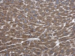 Invitrogen PLA2G4A Polyclonal Antibody 100 &mu;L; Unconjugated:Antibodies,