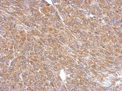 Invitrogen PLA2G4A Polyclonal Antibody 100 &mu;L; Unconjugated:Antibodies,