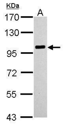 Invitrogen PLA2G4A Polyclonal Antibody 100 &mu;L; Unconjugated:Antibodies,