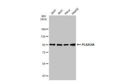 Invitrogen PLA2G4A Polyclonal Antibody 100 &mu;L; Unconjugated:Antibodies,