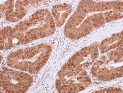 Invitrogen HDAC4 Polyclonal Antibody 100 &mu;L; Unconjugated:Antibodies,