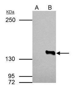 Invitrogen HDAC4 Polyclonal Antibody 100 &mu;L; Unconjugated:Antibodies,