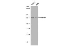 Invitrogen HDAC4 Polyclonal Antibody 100 &mu;L; Unconjugated:Antibodies,