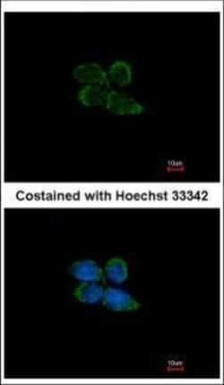 Invitrogen PAPSS2 Polyclonal Antibody 100 &mu;L | Buy Online | Invitrogen&trade; | Fisher Scientific