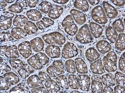 Invitrogen PAPSS2 Polyclonal Antibody 100 &mu;L; Unconjugated:Antibodies,