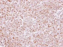 Invitrogen PAPSS2 Polyclonal Antibody 100 &mu;L; Unconjugated:Antibodies,