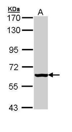 Invitrogen PAPSS2 Polyclonal Antibody 100 &mu;L; Unconjugated:Antibodies,