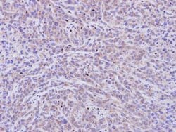 Invitrogen PDE11A Polyclonal Antibody 100 &mu;L; Unconjugated:Antibodies,