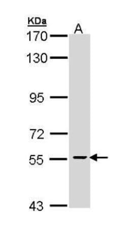 Invitrogen Cdc73 Polyclonal Antibody 100 &mu;L; Unconjugated:Antibodies,