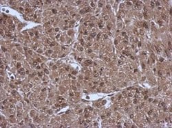 Invitrogen PSMC3 Polyclonal Antibody 100 &mu;L; Unconjugated:Antibodies,