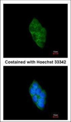 Invitrogen SAP102 Polyclonal Antibody 100 &mu;L; Unconjugated:Antibodies,