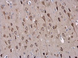 Invitrogen SAP102 Polyclonal Antibody 100 &mu;L; Unconjugated:Antibodies,