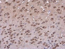 Invitrogen SAP102 Polyclonal Antibody 100 &mu;L; Unconjugated:Antibodies,