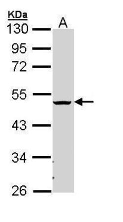 Invitrogen CHST5/CHST6 Polyclonal Antibody 100 &mu;L; Unconjugated:Antibodies,