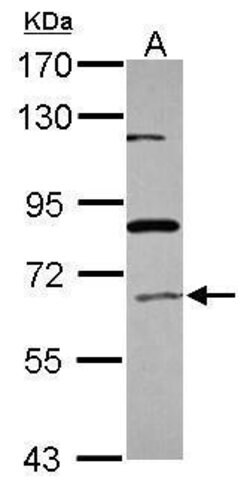 Invitrogen ACOX1 Polyclonal Antibody 100 &mu;L; Unconjugated:Antibodies,