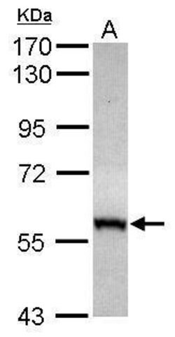Invitrogen CABC1 Polyclonal Antibody 100 &mu;L | Buy Online | Invitrogen&trade; | Fisher Scientific