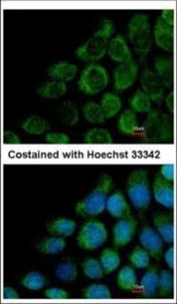 Invitrogen COG8 Polyclonal Antibody 100 μL; Unconjugated:Antibodies,