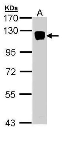 Invitrogen XYLT2 Polyclonal Antibody 100 &mu;L; Unconjugated:Antibodies,