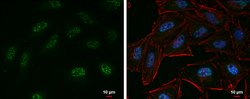 EZH2 Polyclonal Antibody, Invitrogen 100 &mu;L; Unconjugated:Antibodies,