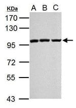 EZH2 Polyclonal Antibody, Invitrogen™
