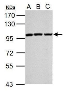 EZH2 Polyclonal Antibody, Invitrogen 100 &mu;L; Unconjugated:Antibodies,
