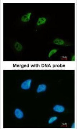 Invitrogen SMC3 Polyclonal Antibody 100 μL; Unconjugated:Antibodies,