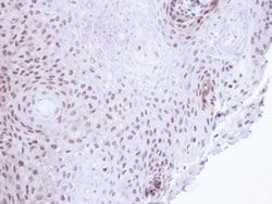 Invitrogen SMC3 Polyclonal Antibody 100 μL; Unconjugated:Antibodies,