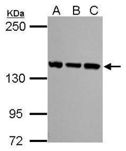 Invitrogen SMC3 Polyclonal Antibody 100 μL; Unconjugated:Antibodies,
