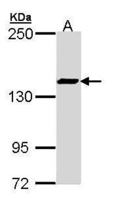 Invitrogen SMC3 Polyclonal Antibody 100 μL; Unconjugated:Antibodies,