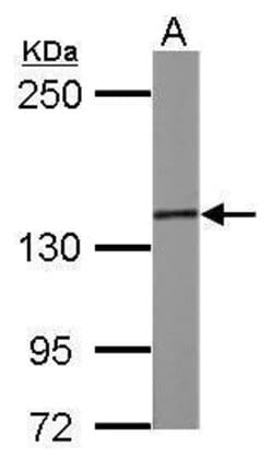 Invitrogen SMC3 Polyclonal Antibody 100 μL; Unconjugated:Antibodies,