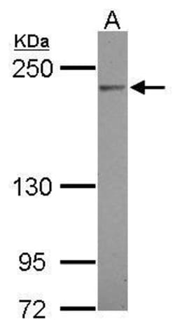 Invitrogen Complement C4 Polyclonal Antibody 100 &mu;L; Unconjugated:Antibodies,