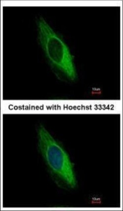 Invitrogen Cytokeratin 6 Polyclonal Antibody 100 &mu;L | Buy Online | Invitrogen&trade; | Fisher Scientific