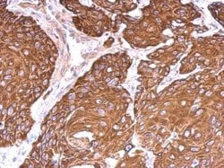Invitrogen Cytokeratin 6 Polyclonal Antibody 100 &mu;L; Unconjugated:Antibodies,