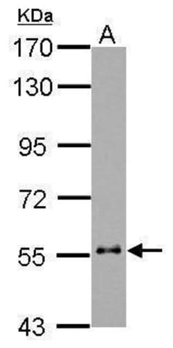 Invitrogen Cytokeratin 6 Polyclonal Antibody 100 &mu;L; Unconjugated:Antibodies,