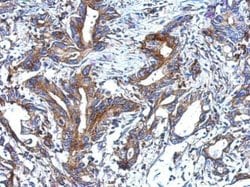 Invitrogen alpha-ENaC Polyclonal Antibody 100 &mu;L; Unconjugated:Antibodies,