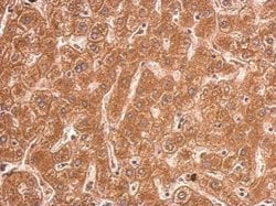 Invitrogen TFR2 Polyclonal Antibody 100 μL; Unconjugated:Antibodies,