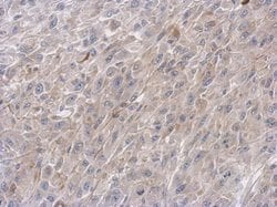 Invitrogen VPS33B Polyclonal Antibody 100 &mu;L; Unconjugated:Antibodies,