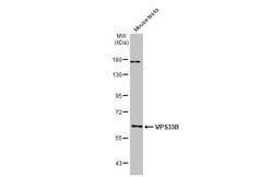 Invitrogen VPS33B Polyclonal Antibody 100 &mu;L; Unconjugated:Antibodies,