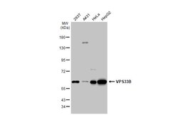 Invitrogen VPS33B Polyclonal Antibody 100 &mu;L; Unconjugated:Antibodies,